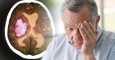لماذا ترتفع السكتات الدماغية صباحاً؟ دراسة تكشف الأسباب والوقاية